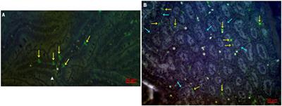 Effects of Newcastle Disease Virus Infection on Chicken Intestinal Intraepithelial Natural Killer Cells
